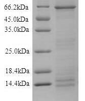 Recombinant Human Desmoglein-1 (DSG1), partial Protein - BioCrest Sci