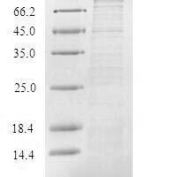 Recombinant Human TIR domain-containing adapter molecule 1 (TICAM1) Protein - BioCrest Sci