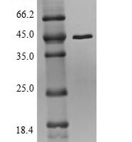 Recombinant Anaplasma phagocytophilum 50S ribosomal protein L22 (rplV) Protein - BioCrest Sci
