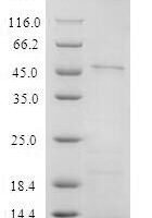 Recombinant Human T-cell surface glycoprotein CD4 (CD4), partial Protein - BioCrest Sci