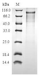 Recombinant Human Progesterone-induced-blocking factor 1 (PIBF1) Protein, Homo sapiens(Human), in vitro E.coli expression system, N-terminal 10xHis-tagged and C-terminal Myc-tagged, 94.8kDa, purity >90% as determined by SDS-PAGE.