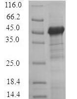 (Tris-Glycine gel) Discontinuous SDS-PAGE (reduced) with 5% enrichment gel and 15% separation gel.