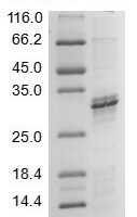 (Tris-Glycine gel) Discontinuous SDS-PAGE (reduced) with 5% enrichment gel and 15% separation gel.