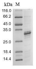 (Tris-Glycine gel) Discontinuous SDS-PAGE (reduced) with 5% enrichment gel and 15% separation gel.