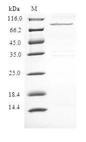 Recombinant Human Protein AF-9 (MLLT3) Protein, Homo sapiens(Human), in vitro E.coli expression system, N-terminal 6xHis-B2M-tagged, 77.4kDa, purity >90% as determined by SDS-PAGE.