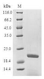 Recombinant Human Pulmonary surfactant-associated protein B (SFTPB) Protein, Homo sapiens(Human), in vitro E.coli expression system, N-terminal 6xHis-SUMO-tagged, 24.7kDa, purity >90% as determined by SDS-PAGE.Greater than 90% as determined by SEC-HPLC.