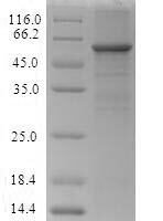 (Tris-Glycine gel) Discontinuous SDS-PAGE (reduced) with 5% enrichment gel and 15% separation gel.