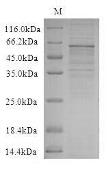 Recombinant Human Protein Wnt-2b (WNT2B) Protein, Homo sapiens(Human), in vitro E.coli expression system, N-terminal 6xHis-SUMO-tagged, 59.8kDa, purity >90% as determined by SDS-PAGE.
