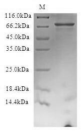 Recombinant Human F-box/WD repeat-containing protein 7 (FBXW7) Protein, Homo sapiens(Human), in vitro E.coli expression system, N-terminal 6xHis-tagged, 83.7kDa, purity >90% as determined by SDS-PAGE.
