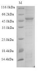 Recombinant Human herpesvirus 2 Tegument protein VP22 (UL49) Protein, Human herpesvirus 2 (strain HG52) (HHV-2) (Human herpes simplex virus 2), in vitro E.coli expression system, N-terminal 6xHis-B2M-tagged, 45.8kDa, purity >90% as determined by SDS-PAGE.