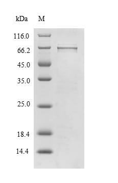 Recombinant Thioredoxin-interacting protein (TXNIP) Protein, Homo sapiens(Human), in vitro E.coli expression system, N-terminal 6xHis-SUMO-tagged, 59.7kDa, purity >90% as determined by SDS-PAGE.