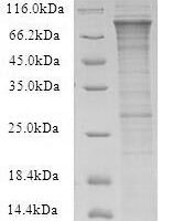 Recombinant Human E3 ubiquitin-protein ligase COP1 (COP1) Protein - BioCrest Sci