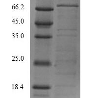 Recombinant Human RNA exonuclease 4 (REXO4) Protein - BioCrest Sci