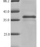 Recombinant Mouse Beta-tectorin (Tectb) Protein - BioCrest Sci