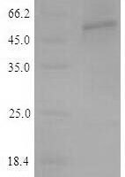 Recombinant Human Tryptophan 5-hydroxylase 2 (TPH2) Protein - BioCrest Sci