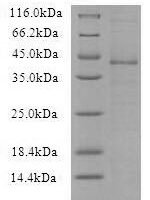 Recombinant Vaccinia virus Protein L3 (VACWR090) Protein - BioCrest Sci