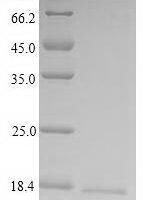 Recombinant Human Bone marrow proteoglycan (PRG2) Protein - BioCrest Sci