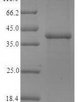 Recombinant Human Pulmonary surfactant-associated protein A1 (SFTPA1) Protein - BioCrest Sci
