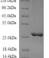 Recombinant Mouse Cerebellin-3 (Cbln3) Protein - BioCrest Sci