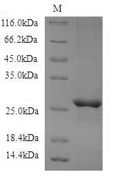 Recombinant Mouse Cerebellin-3 (Cbln3) Protein, Mus musculus (Mouse), in vitro E.coli expression system, N-terminal 6xHis-tagged, 22.4kDa, purity >90% as determined by SDS-PAGE.