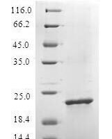 Recombinant Plasmodium berghei Major facilitator superfamily domain-containing protein,partial Protein - BioCrest Sci
