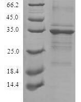 Recombinant Human Transmembrane protein 59 (TMEM59) Protein - BioCrest Sci