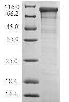 Recombinant Escherichia coli Adenylate cyclase (cyaA) Protein - BioCrest Sci