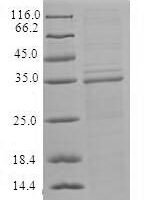 Recombinant Cucumber mosaic virus Helicase (ORF1a) Protein - BioCrest Sci