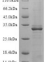 Recombinant Human B-lymphocyte antigen CD19 (CD19), partial Protein - BioCrest Sci