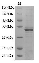 Recombinant Human B-lymphocyte antigen CD19 (CD19), partial Protein, Homo sapiens(Human), in vitro E.coli expression system, C-terminal 6xHis-tagged, 30.8kDa, purity >90% as determined by SDS-PAGE.