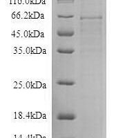 Recombinant Thioredoxin-interacting protein (TXNIP) Protein - BioCrest Sci