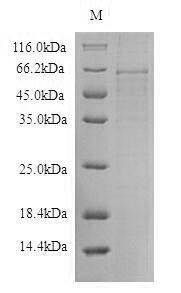 Recombinant Thioredoxin-interacting protein (TXNIP) Protein, Homo sapiens(Human), in vitro E.coli expression system, N-terminal 6xHis-B2M-tagged, 57.7kDa, purity >90% as determined by SDS-PAGE.
