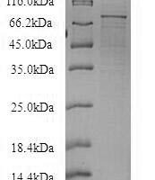 Recombinant Human RNA exonuclease 4 (REXO4) Protein - BioCrest Sci