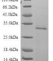 Recombinant Human Bone marrow proteoglycan (PRG2) Protein - BioCrest Sci