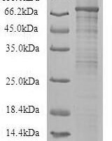 Recombinant Human Toll-like receptor 10 (TLR10), partial Protein - BioCrest Sci