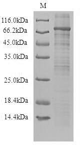 Recombinant Human Toll-like receptor 10 (TLR10), partial Protein, Homo sapiens(Human), in vitro E.coli expression system, N-terminal 10xHis-SUMO-tagged and C-terminal Myc-tagged, 84.6kDa, purity >90% as determined by SDS-PAGE.