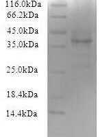 Recombinant Mouse Cerebellin-3 (Cbln3) Protein - BioCrest Sci