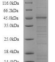 Recombinant Mouse P2X purinoceptor 4 (P2rx4), partial Protein - BioCrest Sci