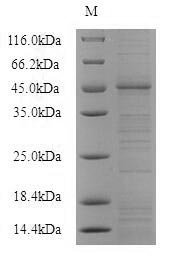 Recombinant Mouse P2X purinoceptor 4 (P2rx4), partial Protein, Mus musculus (Mouse), in vitro E.coli expression system, N-terminal 6xHis-SUMO-tagged, 47.5kDa, purity >90% as determined by SDS-PAGE.