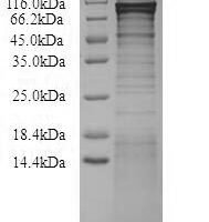 Recombinant Human Nucleolar transcription factor 1 (UBTF) Protein - BioCrest Sci