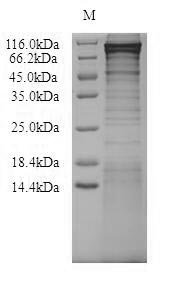 Recombinant Human Nucleolar transcription factor 1 (UBTF) Protein, Homo sapiens(Human), in vitro E.coli expression system, N-terminal 10xHis-SUMO-tagged, 107.9kDa, purity >90% as determined by SDS-PAGE.