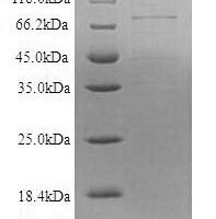 Recombinant Human Desmoglein-1 (DSG1), partial Protein - BioCrest Sci