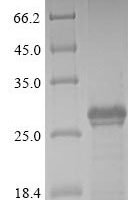 Recombinant Human BPI fold-containing family A member 2 (BPIFA2) Protein - BioCrest Sci