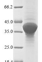 Recombinant Yersinia enterocolitica Outer membrane virulence protein YopE (yopE) Protein - BioCrest Sci