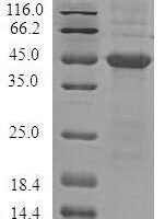Recombinant Human Androgen-dependent TFPI-regulating protein (ADTRP) Protein - BioCrest Sci