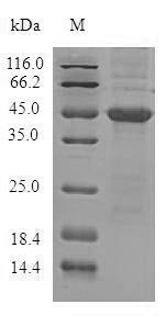 Recombinant Human Androgen-dependent TFPI-regulating protein (ADTRP) Protein, Homo sapiens (Human), in vitro E.coli expression system, N-terminal 10xHis-SUMO-tagged and C-terminal Myc-tagged, 46.8kDa, purity >90% as determined by SDS-PAGE.