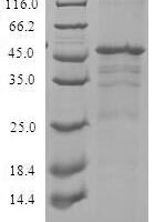Recombinant Human C-X-C chemokine receptor type 3 (CXCR3) Protein - BioCrest Sci