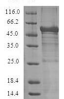 Recombinant Human Adiponectin receptor protein 1 (ADIPOR1) Protein - BioCrest Sci