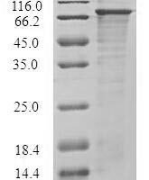 Recombinant Human Diacylglycerol kinase epsilon (DGKE) Protein - BioCrest Sci