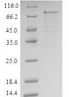 Recombinant Human Interleukin-1 receptor type 1 (IL1R1) Protein - BioCrest Sci